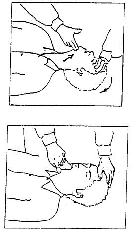 Image retirée.